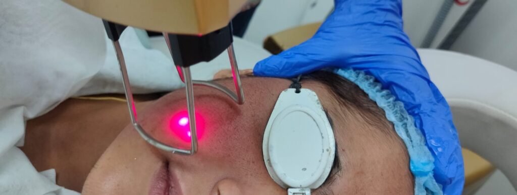 CO2 Laser in ludhiana