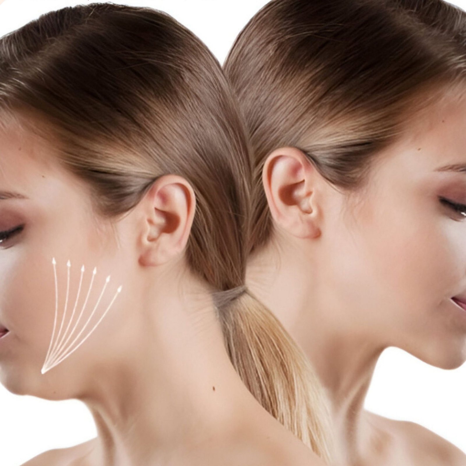double chin treatment