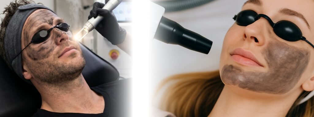 carbon peel treatment in ludhiana